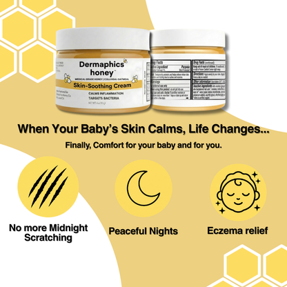 Dermaphics™ Honey Eczema Cream